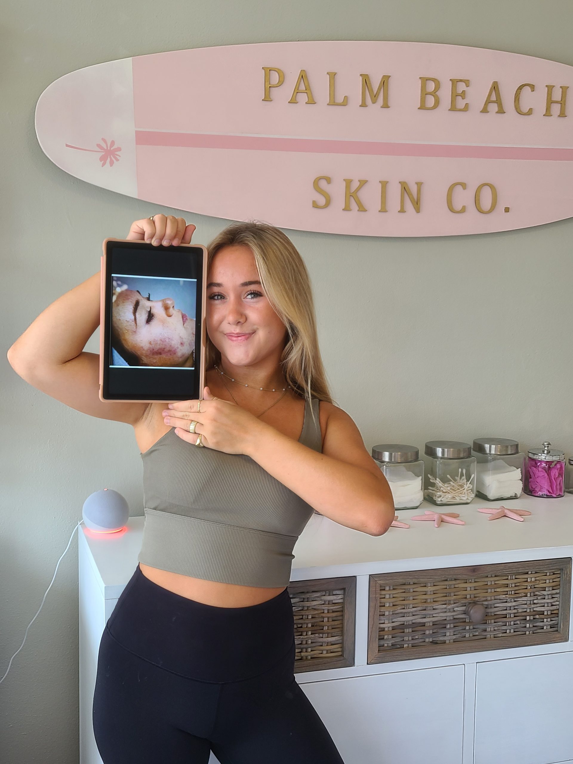 Client reviewing her before and after acne treatment results on an iPad at Palm Beach Skin Co.
